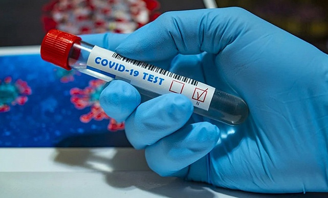 За сутки в Чеченской Республике выявили 115 случаев коронавируса