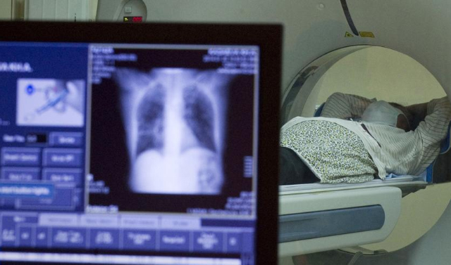 Врачи клиники «АйМед» первыми в мире провели кинематическое исследование МРТ лёгких при COVID-19