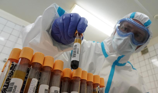 Более 13,5 млн тестов на коронавирус проведено в России 