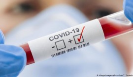 За сутки в России выявили 8 885 заразившихся коронавирусом