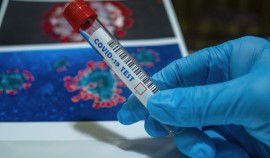 В Чеченской Республике на 3 ноября  подтверждено 2683 случаев COVID-19