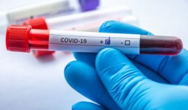 В ЧР за сутки выявлено 2 случая заражения COVID-19