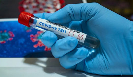 За сутки в Чеченской Республике выявили 115 случаев коронавируса
