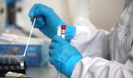 За сутки в России выявили 9 221 случай заражения коронавирусом
