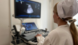 2000 исследований проведено на новом УЗ-аппарате в Поликлинике №1