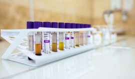 В Чеченской Республике проверили почти 14 000 детей на наличие наследственных заболеваний