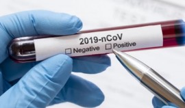 Число заразившихся коронавирусом выросло в мире за минувшую неделю выросло почти на 4 млн