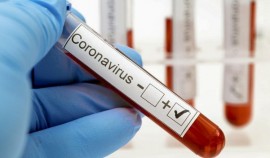 В Чеченской Республике за сутки выявили 14 случаев коронавируса