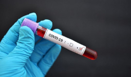 Нельзя ослаблять внимание к пандемии коронавируса