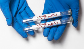 За последние сутки в ЧР выявлено 43 случая заражения COVID-19