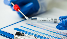 За сутки в ЧР зарегистрировано 16 новых случаев COVID-19