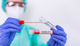 За сутки в ЧР выявлен один случай заражения COVID-19