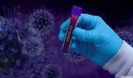 В России провели более 67,3 миллиона тестов на коронавирус