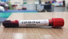 В Чеченской Республике выявлено 11 случаев заражения коронавирусом