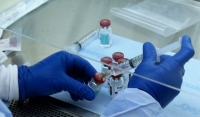 В Чеченской Республике на 21 апреля зарегистрировано 303 случая заражения коронавирусом