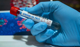 В Чеченской Республике за сутки выявили 75 случаев коронавируса