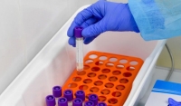 Новую тест-систему для диагностики коронавируса зарегистрируют 27 марта