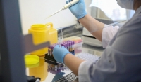 Минздрав ЧР: лаборатории в медучреждениях скоро оснастят тест-системой на коронавирус