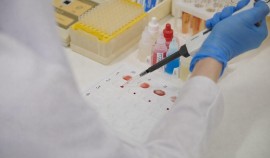 В Чеченской Республике свыше 14 тысяч детей проверили на наследственные болезни в 2025 год