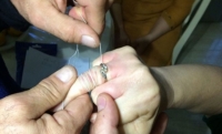 В Грозном спасатели помогли жительнице снять кольцо с опухшего пальца