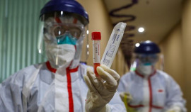 В России создали тест для выявления смертельного вируса нипах
