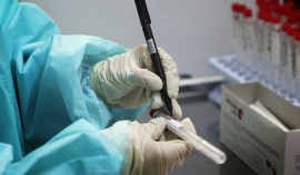 В РФ обнаружен новый штамм коронавируса «Кракен»