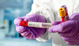 За сутки в ЧР выявили 143 случаев заражения коронавирусом