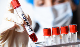 В Госдуме предложили проводить тесты на антитела к COVID-19