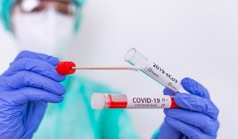 В ЧР за сутки выявили 4 случая заражения COVID-19