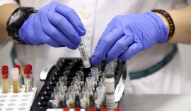 За сутки в ЧР выявили 46 случаев заражения коронавирусом
