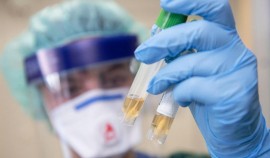 Более тысячи случаев заражения новыми штаммами коронавируса выявлено в России