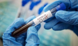 В Чеченской Республике за сутки выявили 127 случаев коронавируса