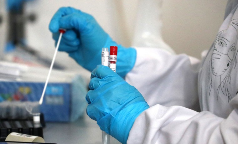 За сутки в ЧР выявили 39 случаев заражения коронавирусом