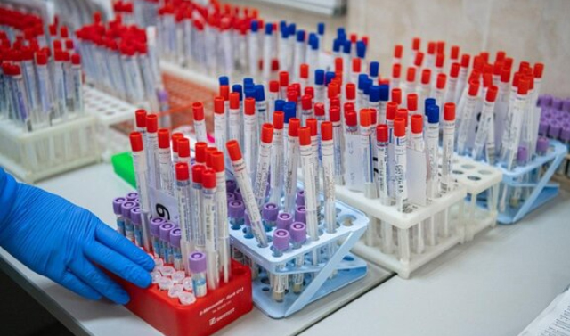 Около 5 млн тестов на коронавирус провели в России 