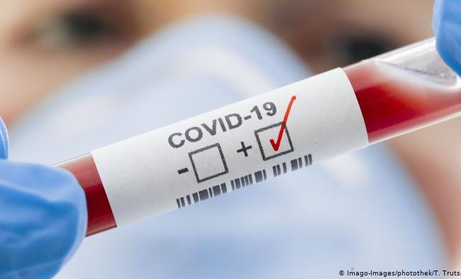 За сутки в России выявили 9 145 заразившихся коронавирусом