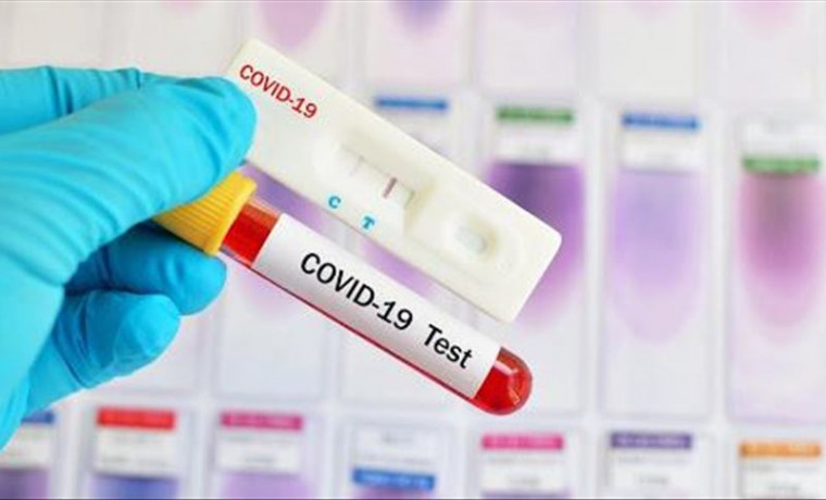 За последние сутки в ЧР выявлено 113 случаев заражения коронавирусом