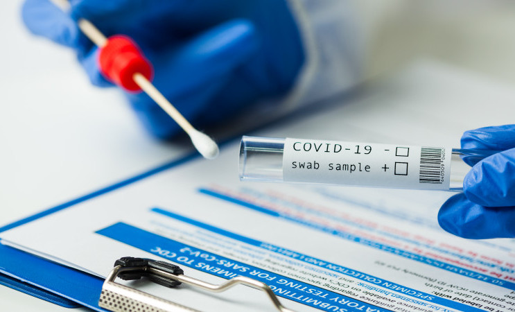 За сутки в ЧР зарегистрировано 16 новых случаев COVID-19