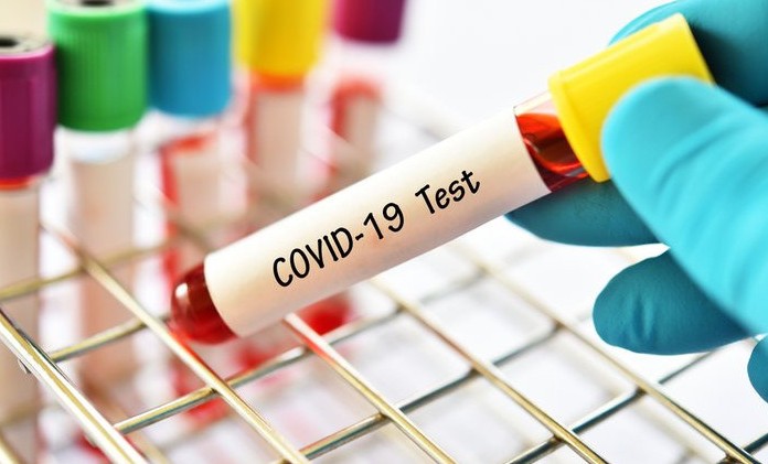 За последние сутки в ЧР выявили 47 случаев заражения COVID-19