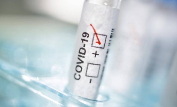 Более 98 млн тестов на коронавирус провели в России