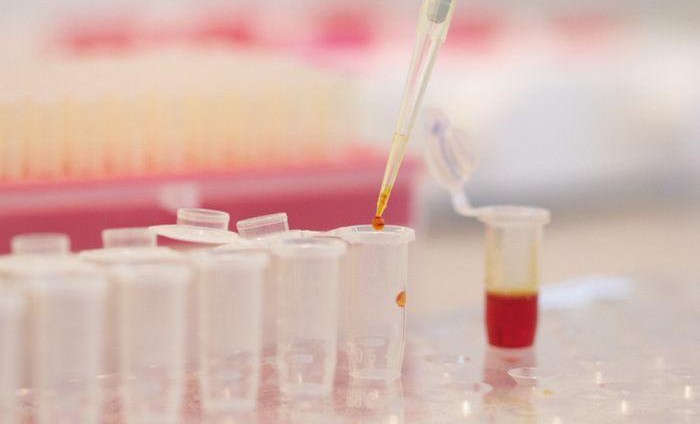 В ЧР ведётся подготовка к предварительному анализу семенного сырья