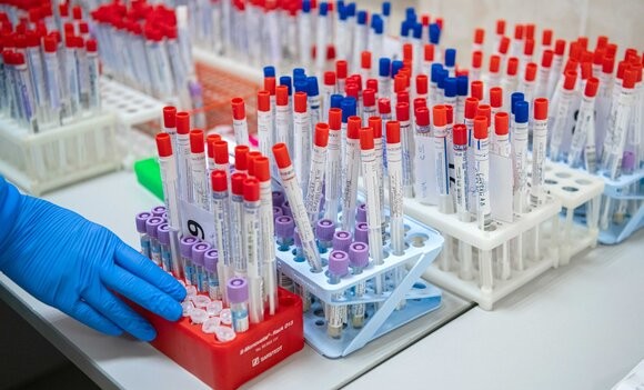 В России провели более 81 миллиона тестов на COVID-19