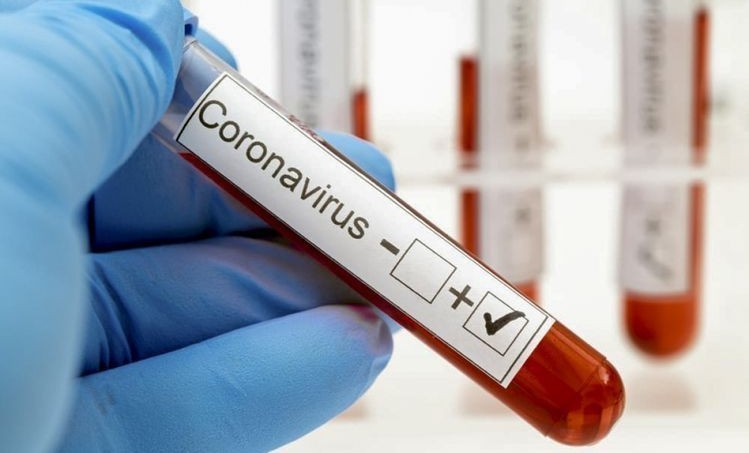 За сутки в Чеченской Республике выявили 123 случаев заражения коронавирусом