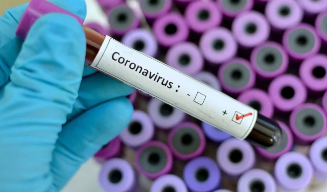 Роспотребнадзор провел более 1 млн тестов на коронавирус