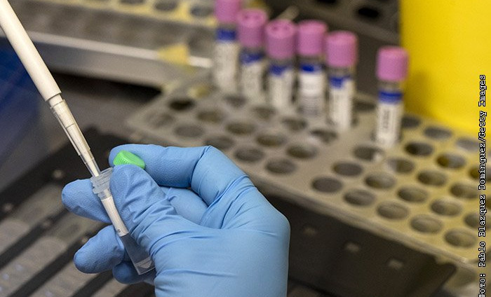 В конце июля Россия передаст тесты на оспу обезьян африканским странам