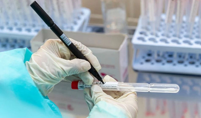 На 5 июня в ЧР подвержено 1306 случаев заражения коронавирусом