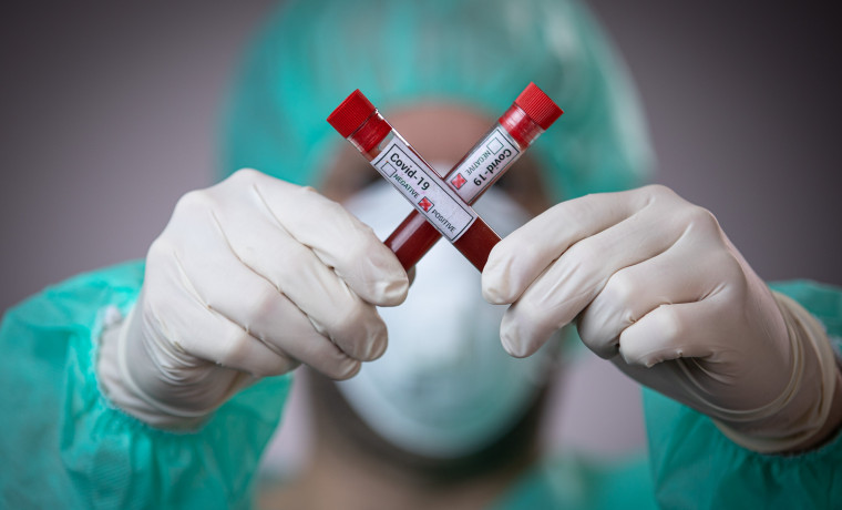 В ЧР за сутки выявлено 72 случая заражения коронавирусом